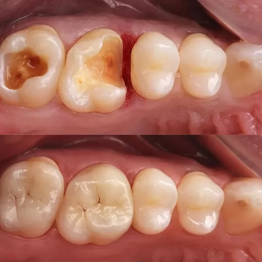 DENT 01 ÇENE CERRAHİSİ UZM. DR. Sadi Coşkun KANAL TEDAVİ UZMANI Uzm. Dr. Nihan Nazsız ve DİŞ HEKİMİ Görkem Güzel Adana Çukurova