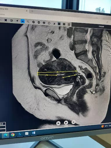 Op.Dr. Ferhat Yasin ÖZKAYA, Kadın Hastalıkları ve Doğum Sakarya Serdivan