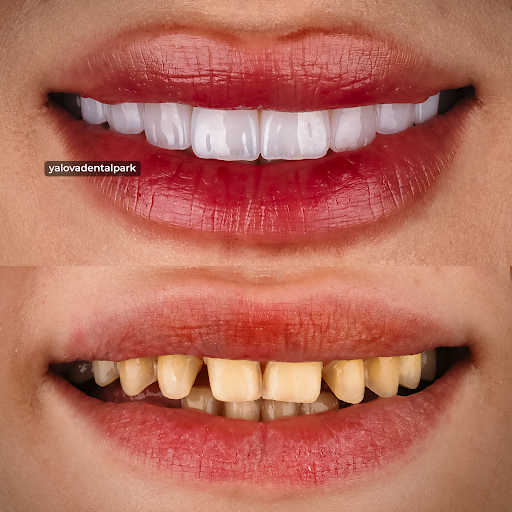 YALOVA DENTAL PARK Yalova Merkez YALOVA DENTAL PARK Yalova Merkez